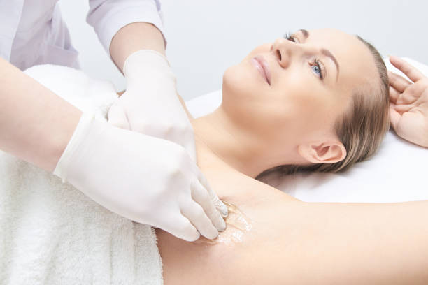 Underarms Chemical Peel