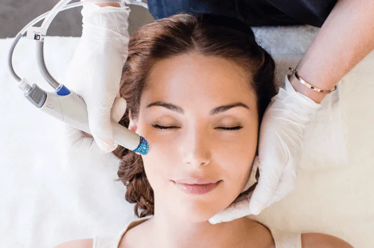 Laser Acne Facial