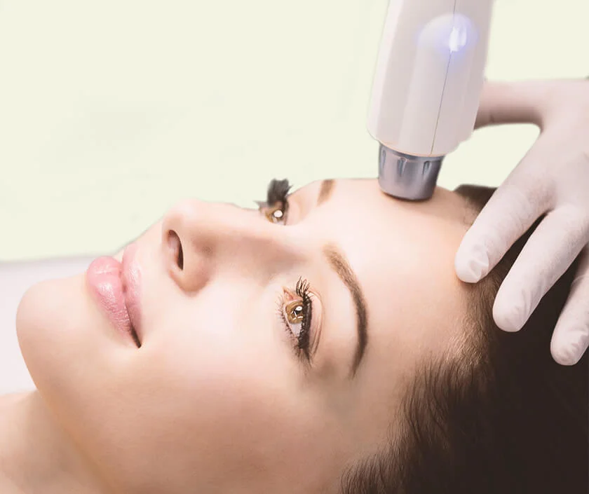 Laser Resurfacing Facial