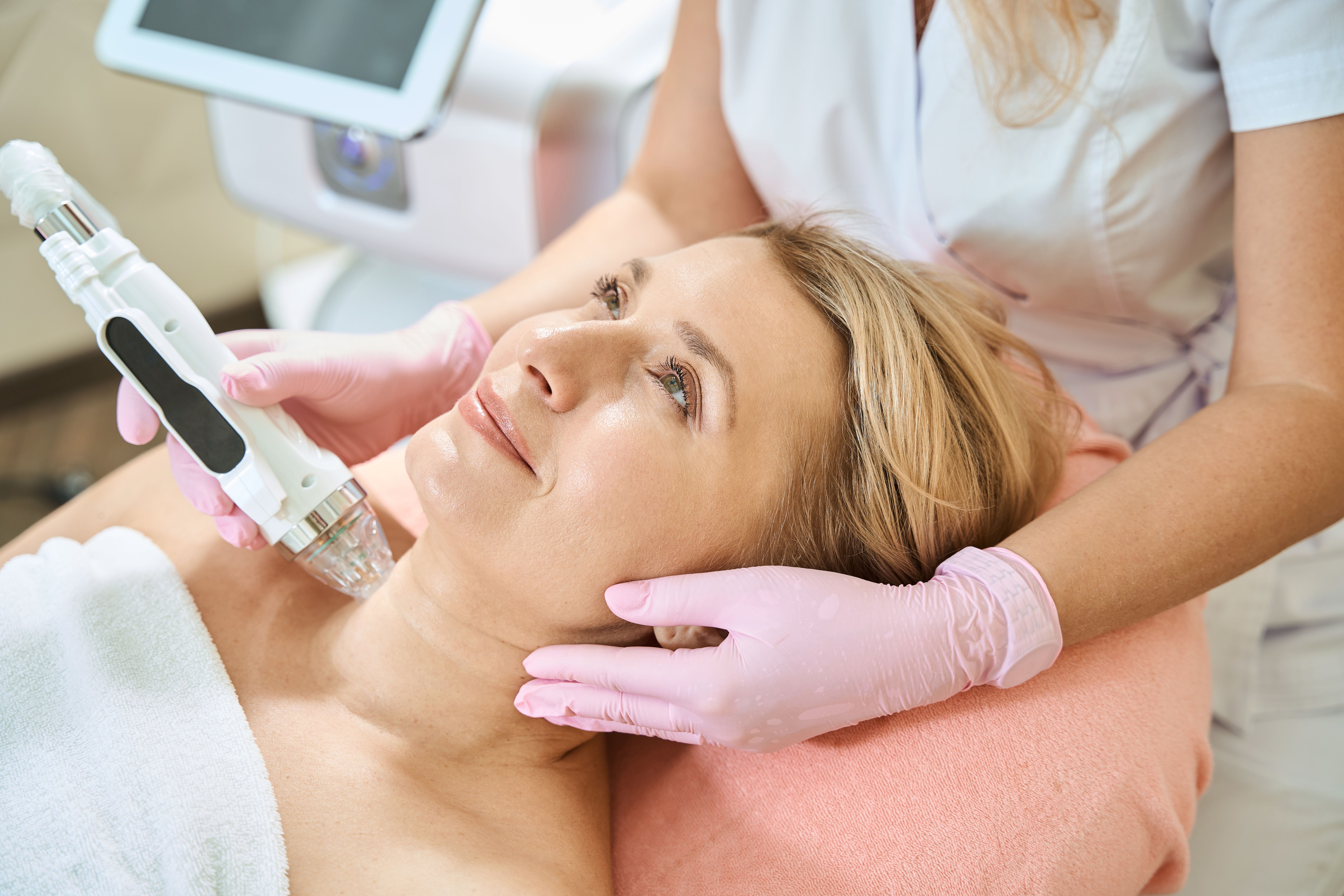 Neck RF Microneedling